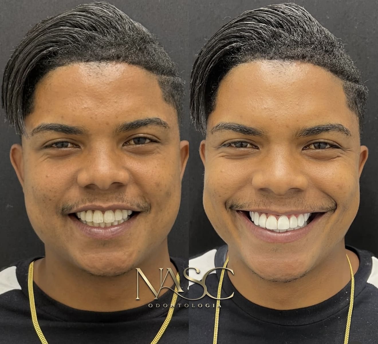 Prancheta 1 copiar 2